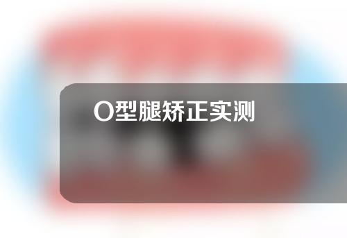 O型腿矫正实测